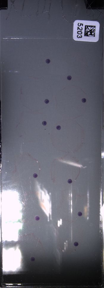 Media type: image; Special Collections 4011   shows specimen_part histological serial section;